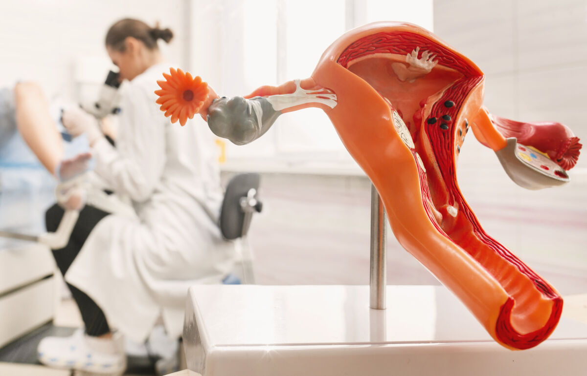 Endometriose betrifft rund jede 10. Frau 