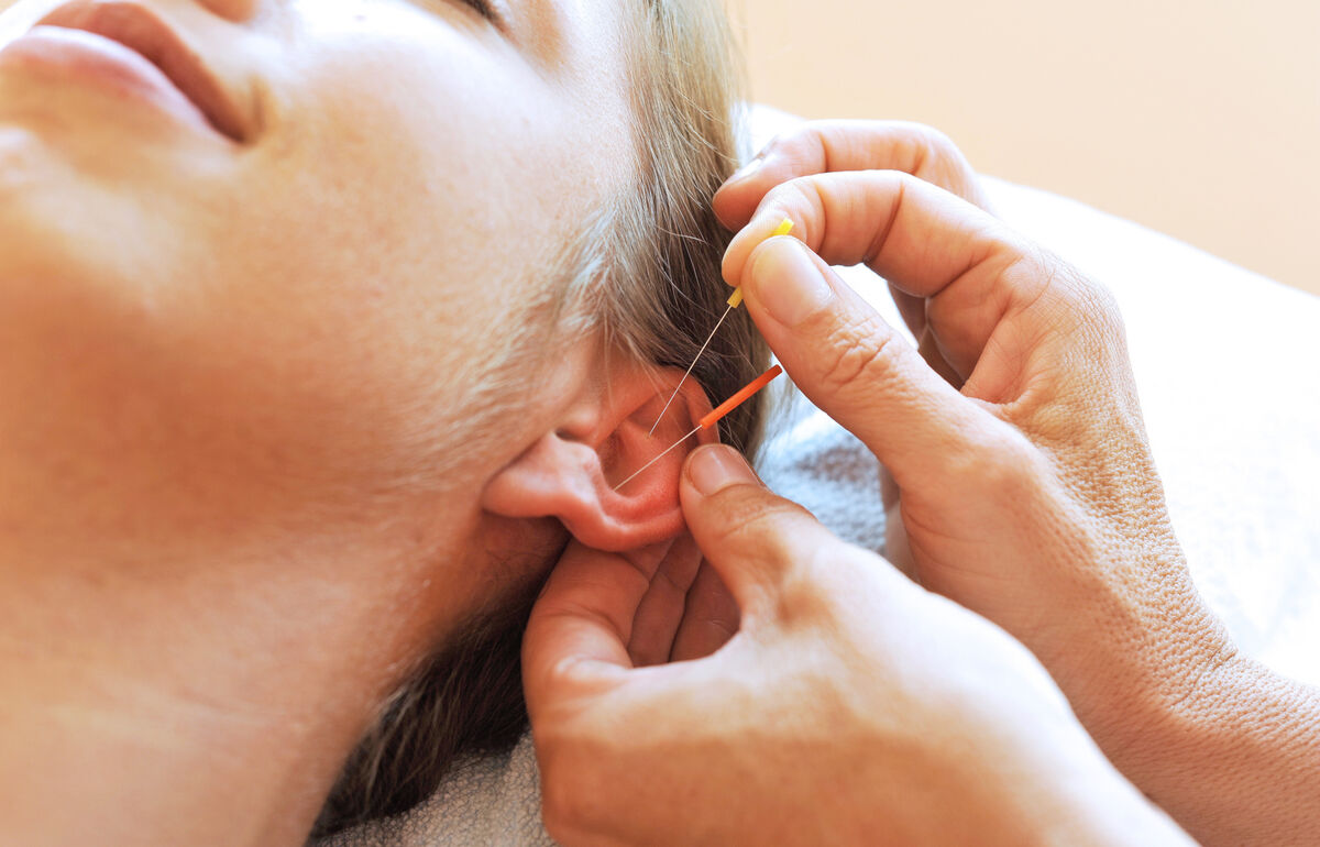 Private Krankenverischerung und Traditionelle Chinesische Medizin (TCM) Akupunktur