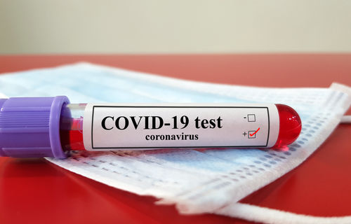 Ein Überblick über die Leistungen privater Krankenversicherungen bei Covid Tests/ Bild: Adobe Stock