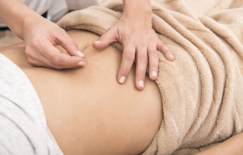 Akupunktur: Die sanfte TCM-Methode eignet sich perfekt für die Schwangerschaft/ Bild: Adobe Stock
