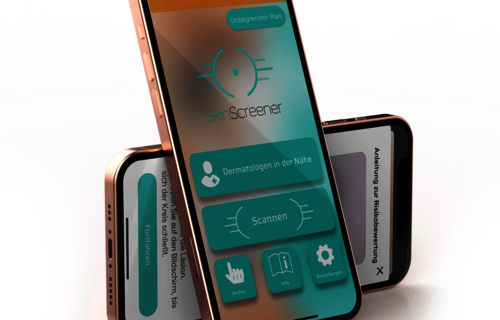 Digitaler Gesundheitscheck für die Haut: SkinScreener / Bild: SkinScreener 