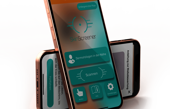 Digitaler Gesundheitscheck für die Haut: SkinScreener / Bild: SkinScreener 